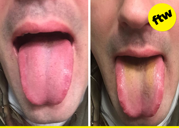 42 Incredible Before And After Product Photos That Belong In The Hall Of Fame 42 Incredible Before And After Product Photos That Belong In The Hall Of Fame