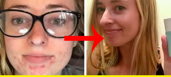 27 Skincare Products With Before-And-After Photos That Gave Me Goosebumps
