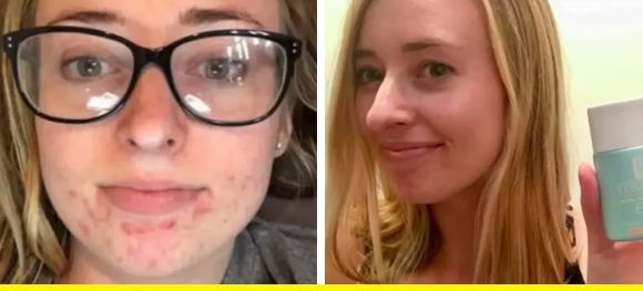 27 Skincare Products With Before-And-After Photos That Gave Me Goosebumps