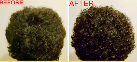 before and after hair shots