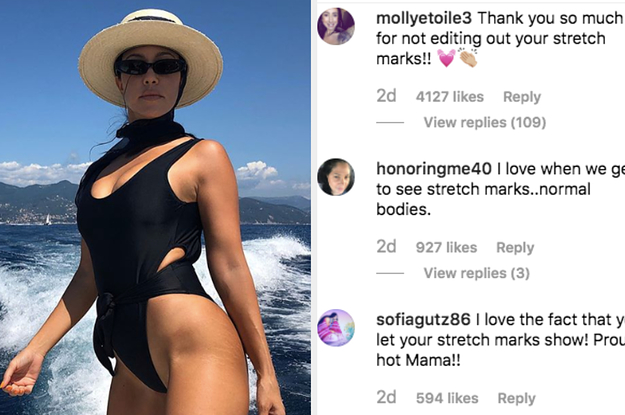 Kourtney Kardashian Shared An Unedited Photo Of Her Stretchmarks And Fans Are Praising Her